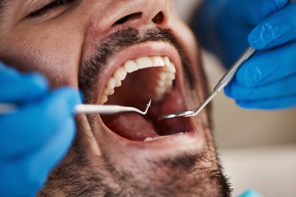 Best Emergency Broken Tooth Repair in Helena, AL
