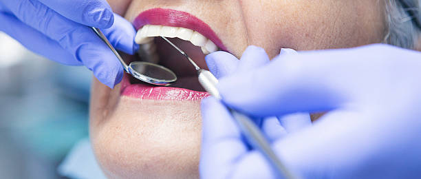 Best Emergency Root Canal Treatment in Helena, AL